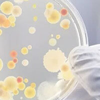 MICROBIOLOGIC DETECTION MICROBIOLOGIC DETECTION